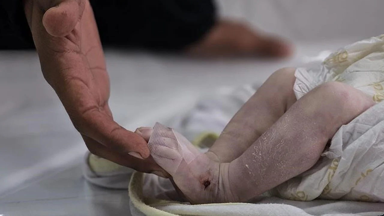 Bombadan kurtuldular, kıştan kurtulamadılar! Gazze’de 10 çocuk soğuktan öldü