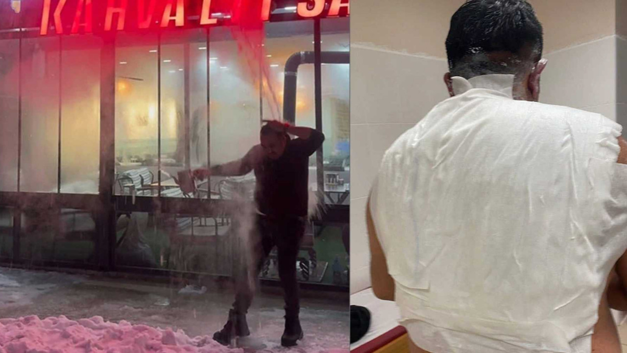 Soğuk havayı test etmek isterken kendini yaktı