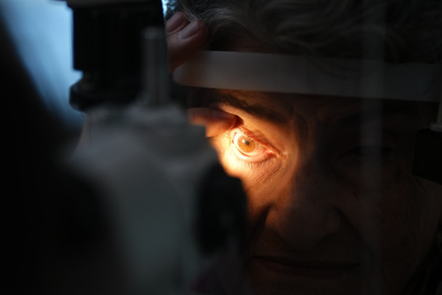 6 Yıllık karanlık kornea nakliyle aydınlandı! Bir organ yeni bir hayat - Resim: 1